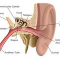 tinnitus symptoms