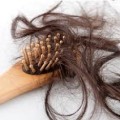 Causes Of Hair Loss