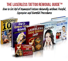 Laserless Tattoo Removal Guide