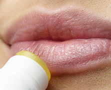 home remeides for herpes